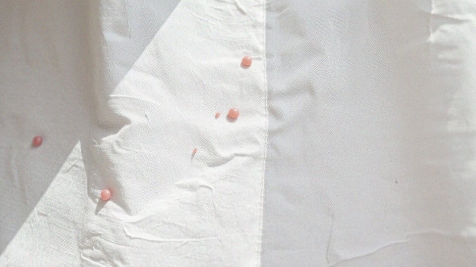 Jakie są różnice między różnymi rodzajami wysypki u dzieci?